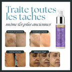 PureSkin Balance - Crème anti-taches