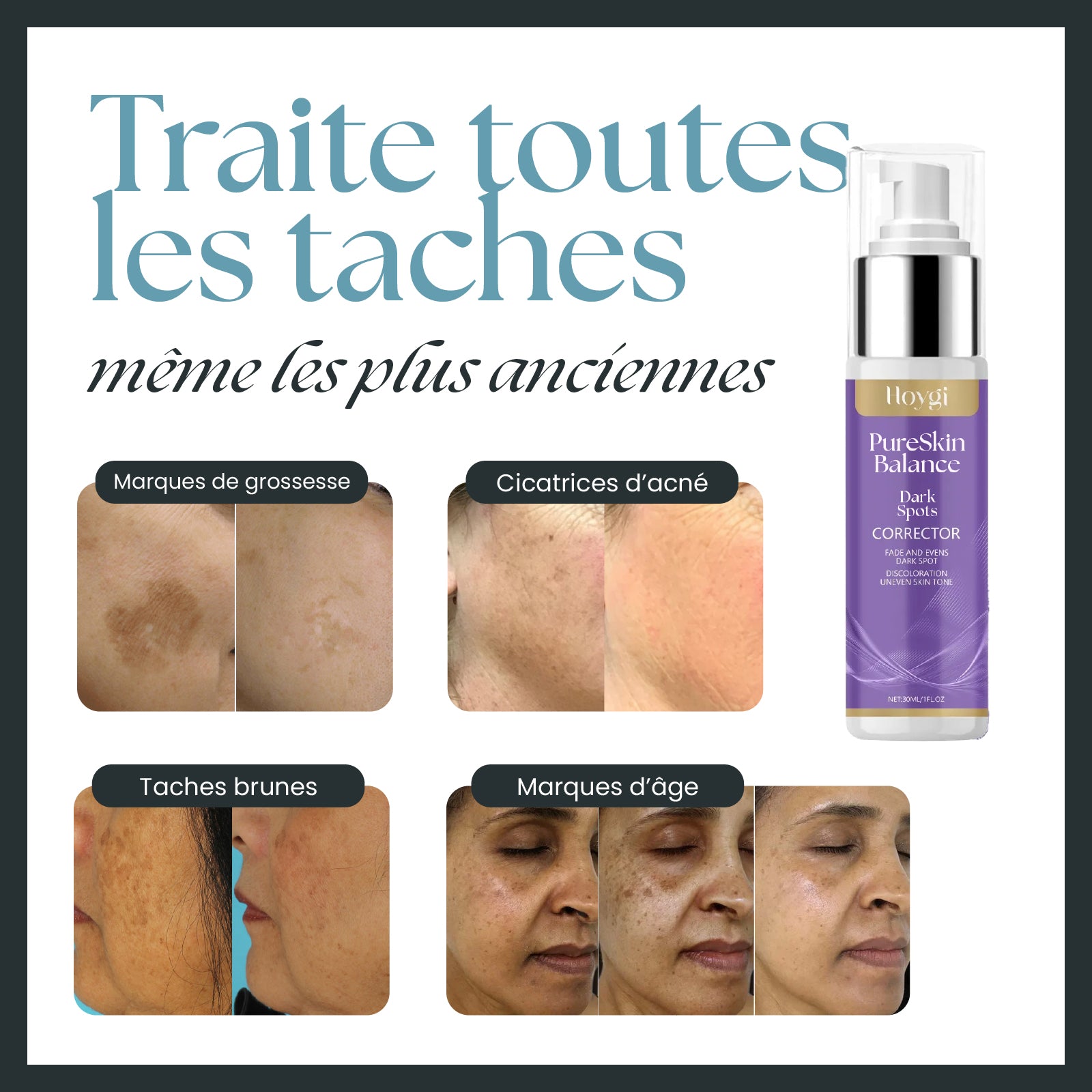PureSkin Balance - Crème anti-taches